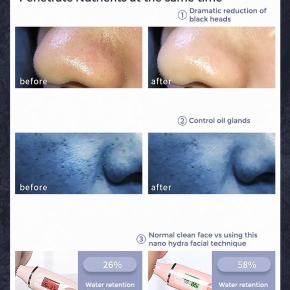 Hydra facial machine with nano spray - Picture 3 of 5